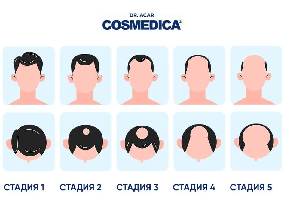 Типы волос. Какой Тип Волос У Тебя? Системы Типирования Волос.