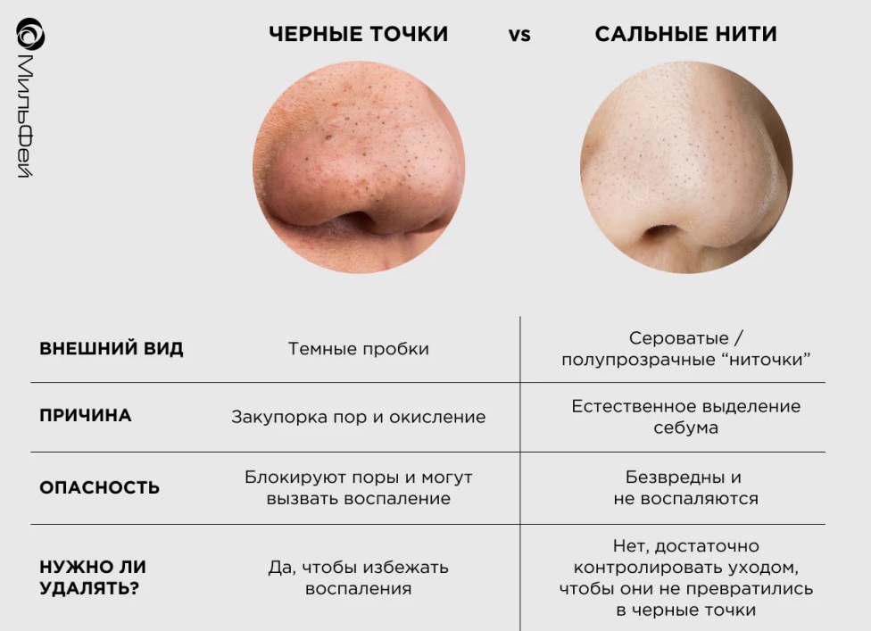 Как Избавиться От Черных Точек И Комедонов На Лице В Подростковом И Зрелом Возрасте