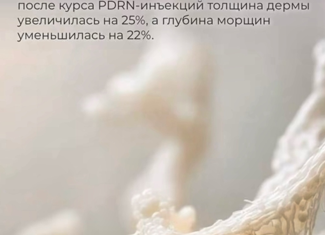 Лазер в косметологии — не тренд